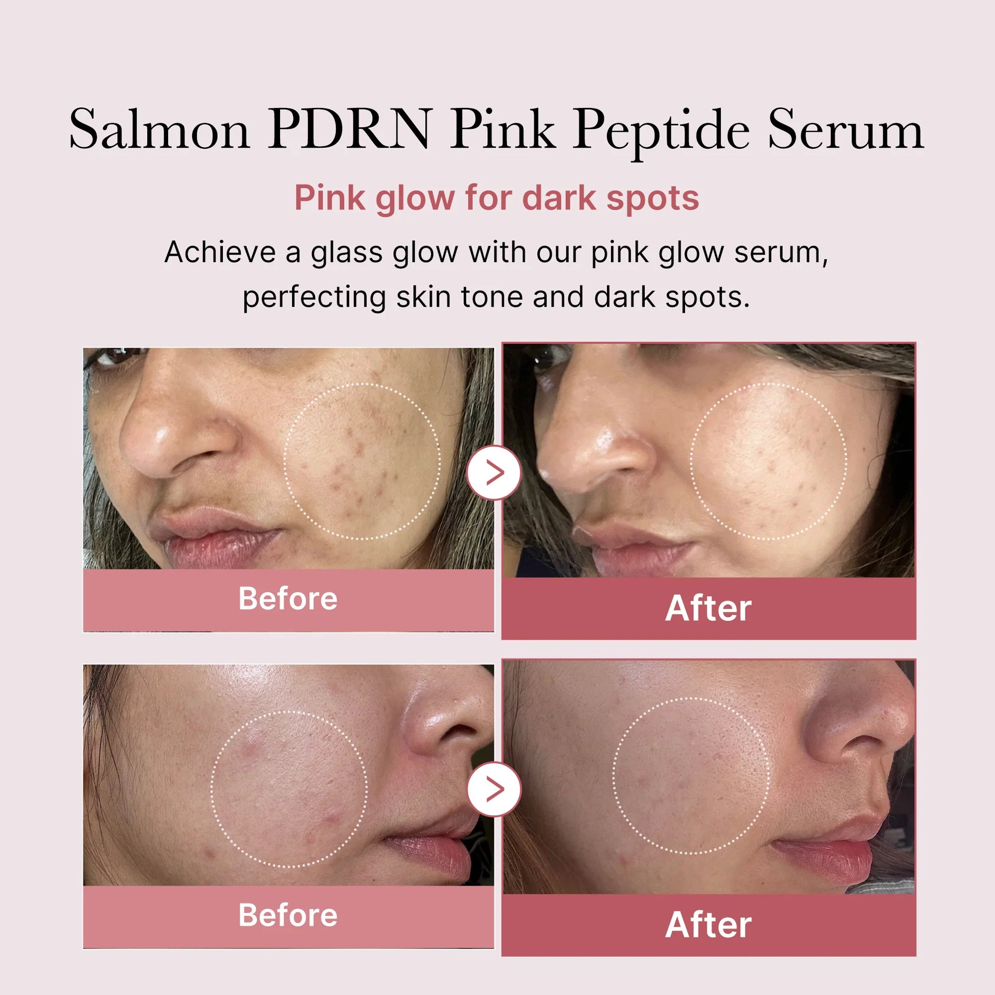 Medicube PDRN pdrn Pink Peptide Serum 30ml