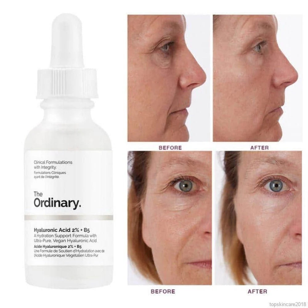 OD- Hyaluronic acid 2% + B5 (30 ml)